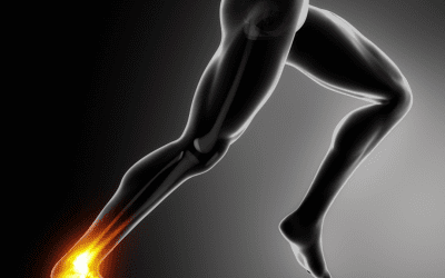 why do my ankles hurt after running or exercise?