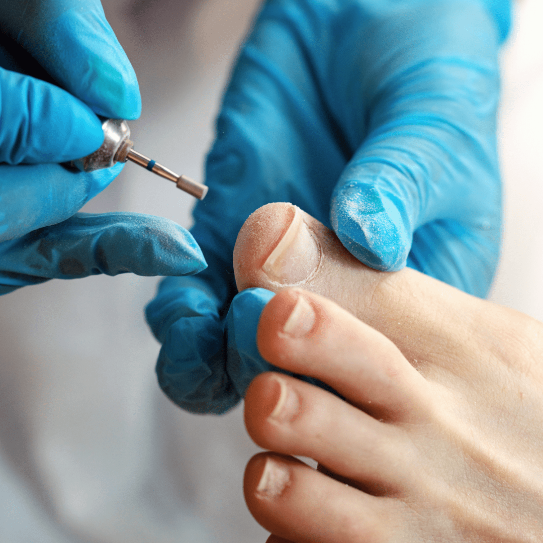 diabetic foot care