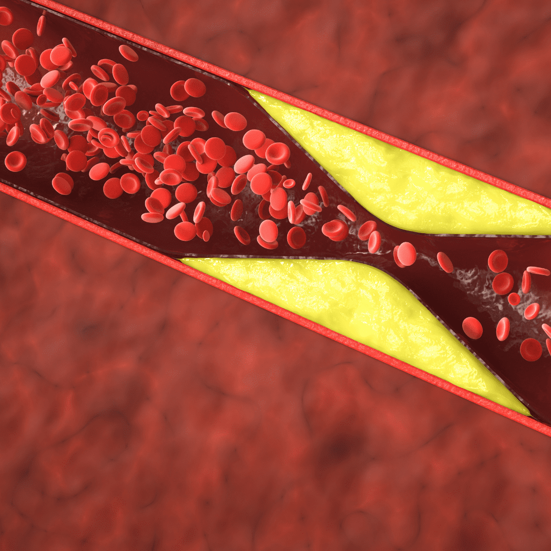 diabetic foot care