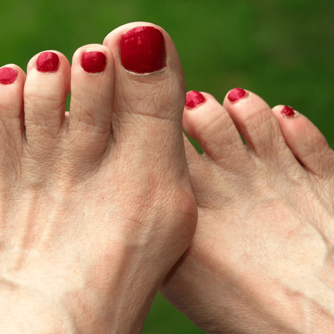 plantar fasciitis guide
