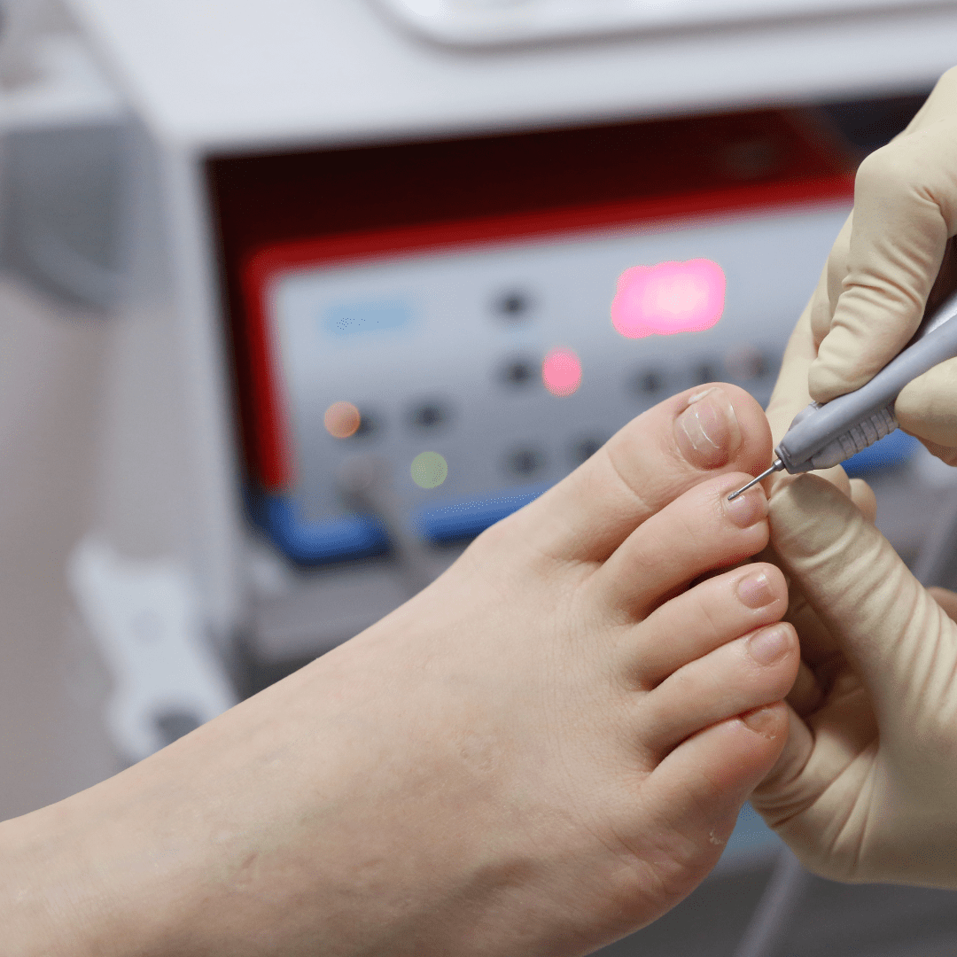 diabetic foot care