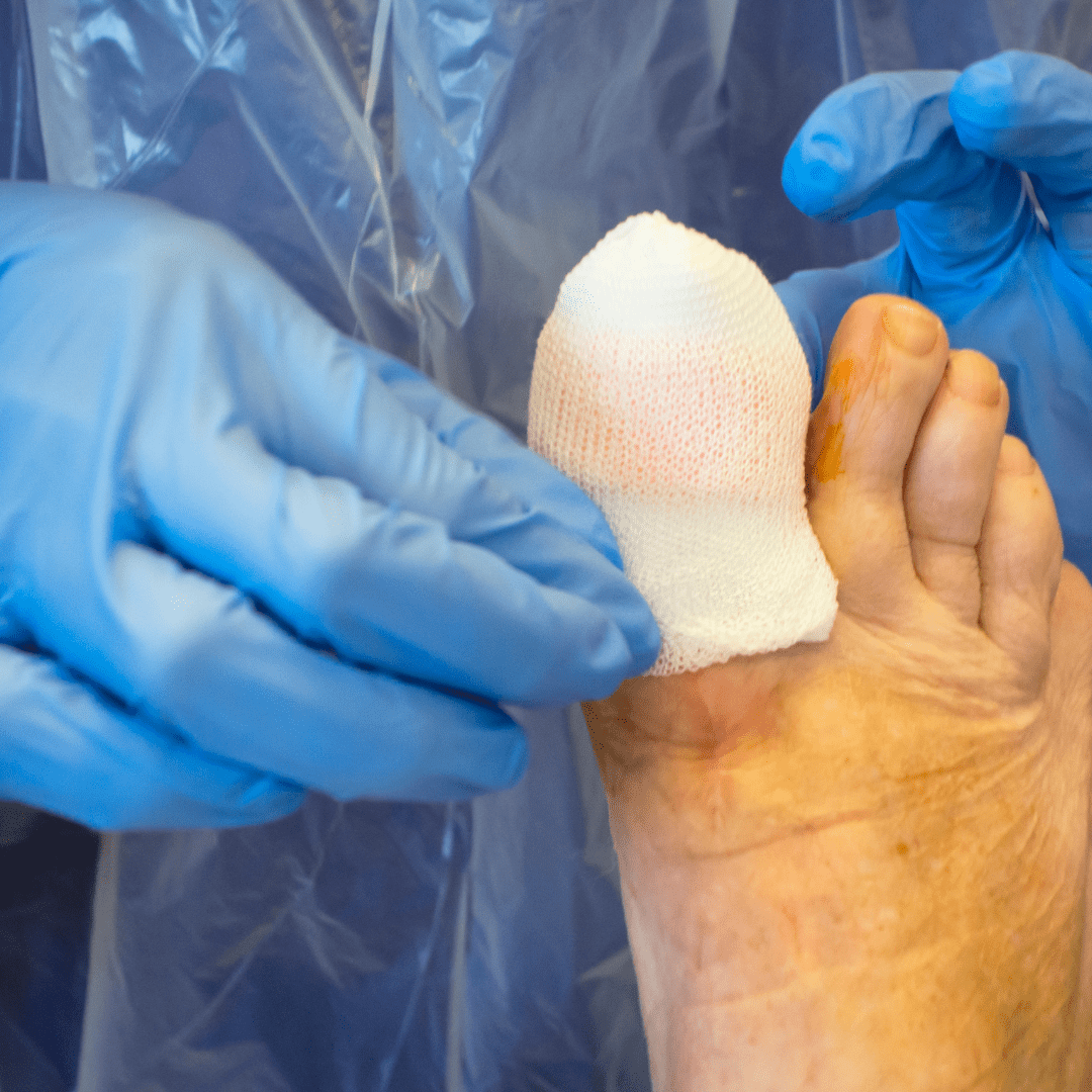 plantar fasciitis guide
