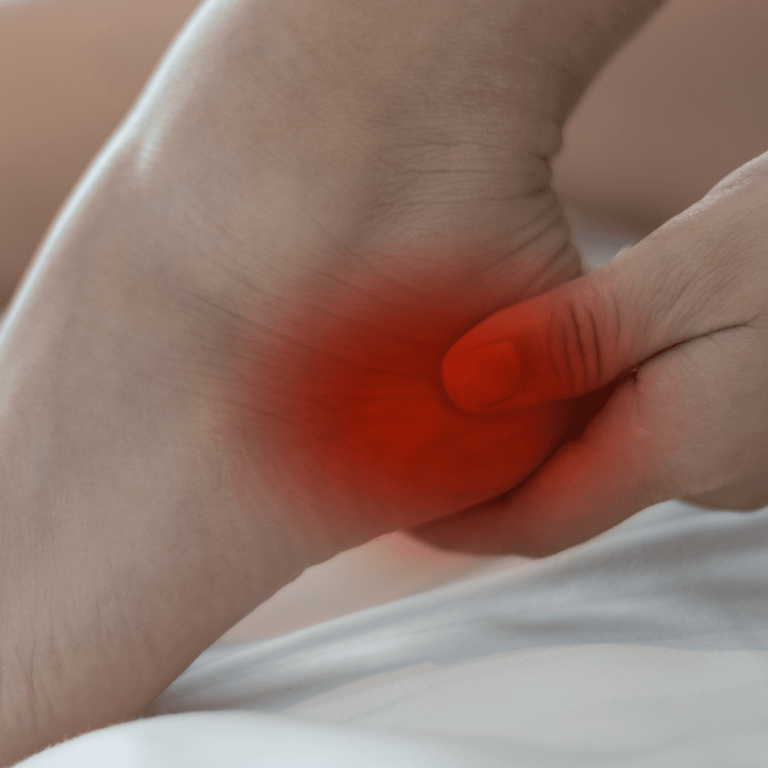 plantar fasciitis guide
