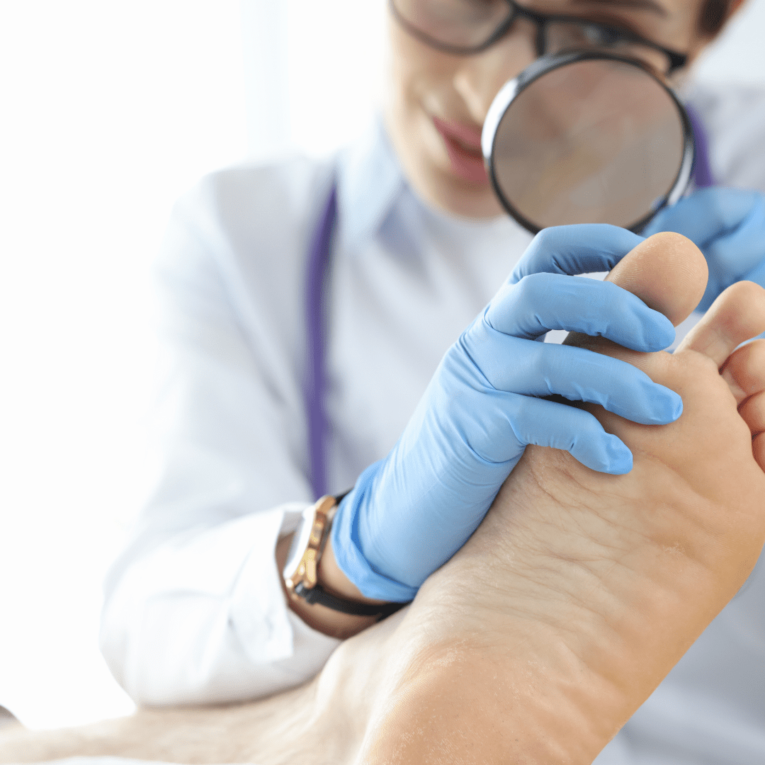 plantar fasciitis flare up