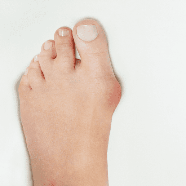 foot circulation test podiatry clinic